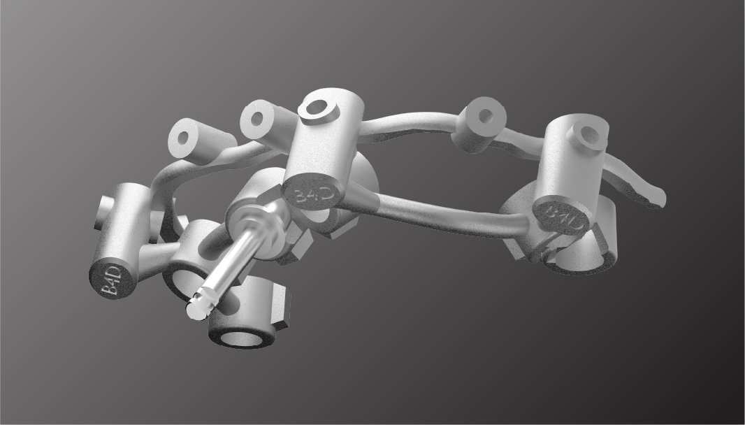 iD-4 Stackable Guide Implant